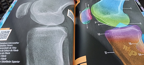 Foto da página de Joelho Perfil do livro Atlas de Anatomia Radiográfica - Radiologia é o Poder