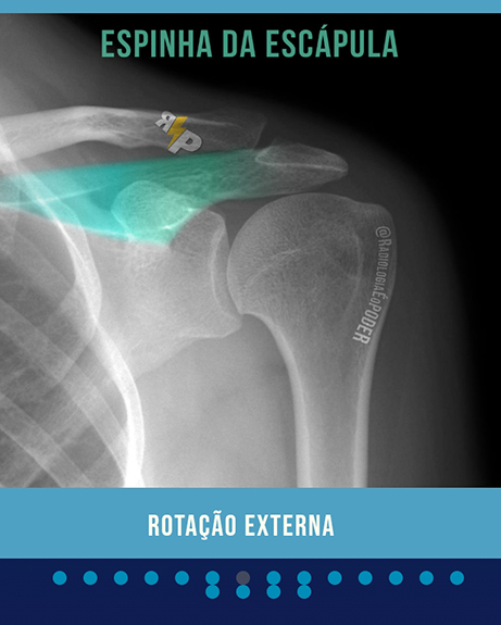 Em nossa plataforma de estudos online, você encontra ilustrações das estruturas anatômicas individuais.