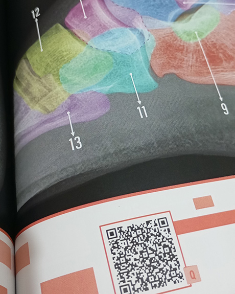 Cada projeção radiográfica acompanha um QRcode que te direciona para nossa plataforma de estudos online.